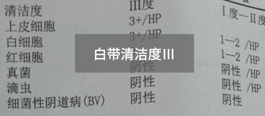 今天快訊！全自動白帶免费深夜福利APP生產廠家深夜福利视频网站為您官方解釋白帶清潔度3的意思