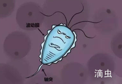 白帶深夜福利影院品牌介紹滴蟲性陰道炎的早期症狀以及預防方法